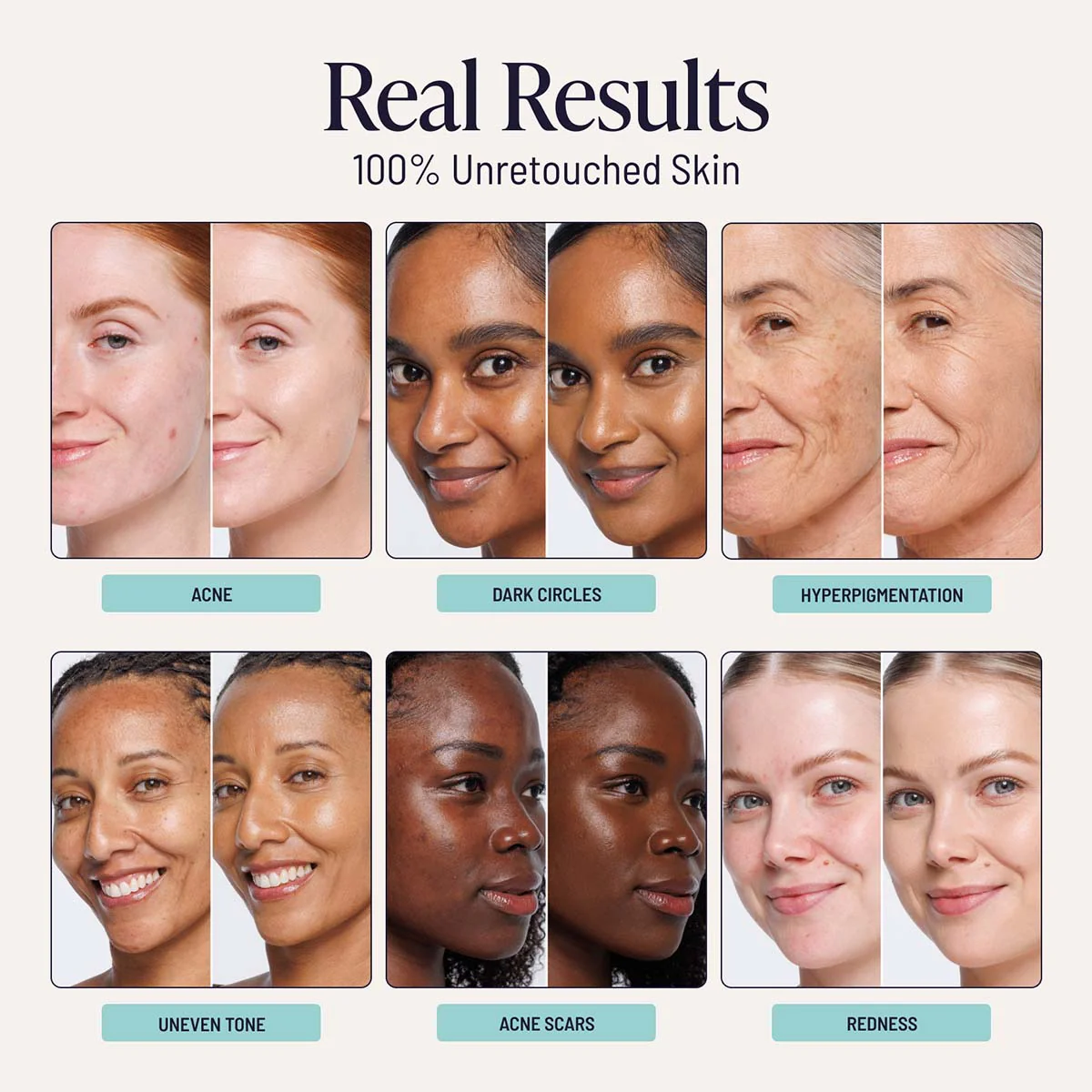 Complexion Perfecting Set - Image 3