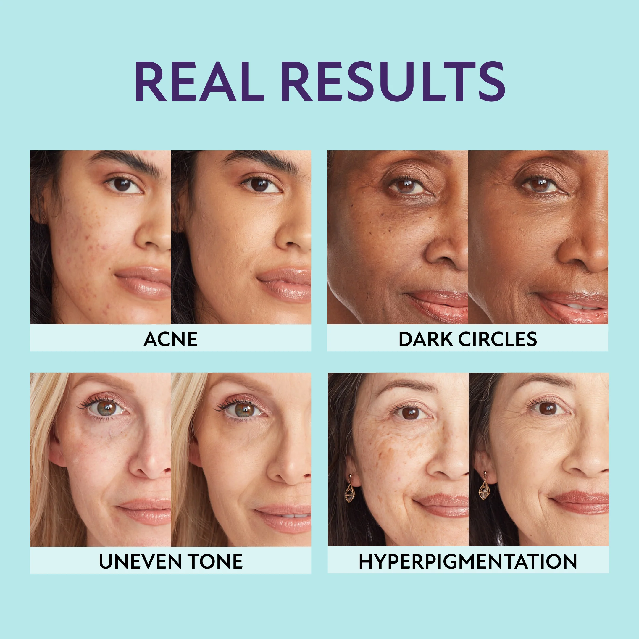 Supreme Complexion Set - Image 3